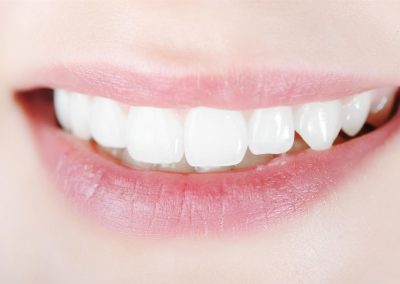 Teeth Whitening Serum Colour Corrector